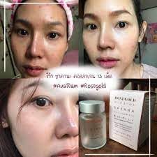 Rosegold SAKANA Collagen x 10