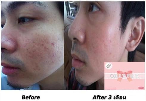 Colly Pink Collagen 6000mg: Dietary Supplements for White and Bright Skin (1 box 30 bags)