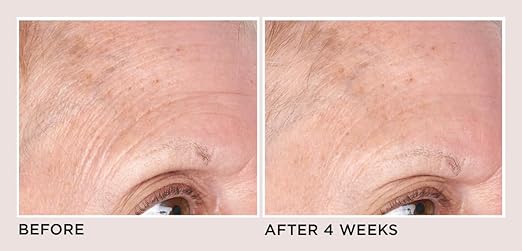 Perricone MD High Potency Classics: Face Finishing &amp Firming Moisturizer