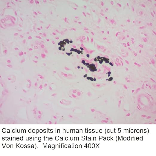Calcium Stain Kit (Modified Von Kossa) 125ml