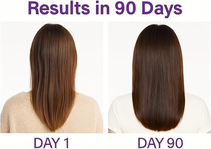 Vita4Life!® Biotin 2000mcg + MSM Hair Growth Vitamins for Women &amp Men | Hair Skin &amp Nail Support Supplement with Vitamin A E Zinc | Fast Absorbing Capsules 60 Count 30-Day Supply