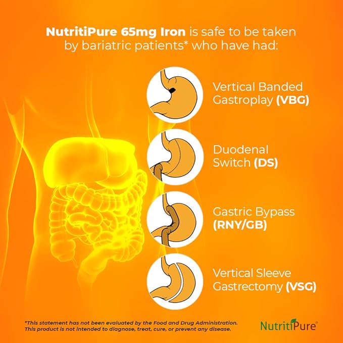 Chewable Carbonyl Iron 65mg Tablets with 270mg Vitamin C – Gentle Non-Constipating Iron Supplement for Women &amp Men – Bariatric Friendly – Sugar Free – 60 Count (60 Day Supply)