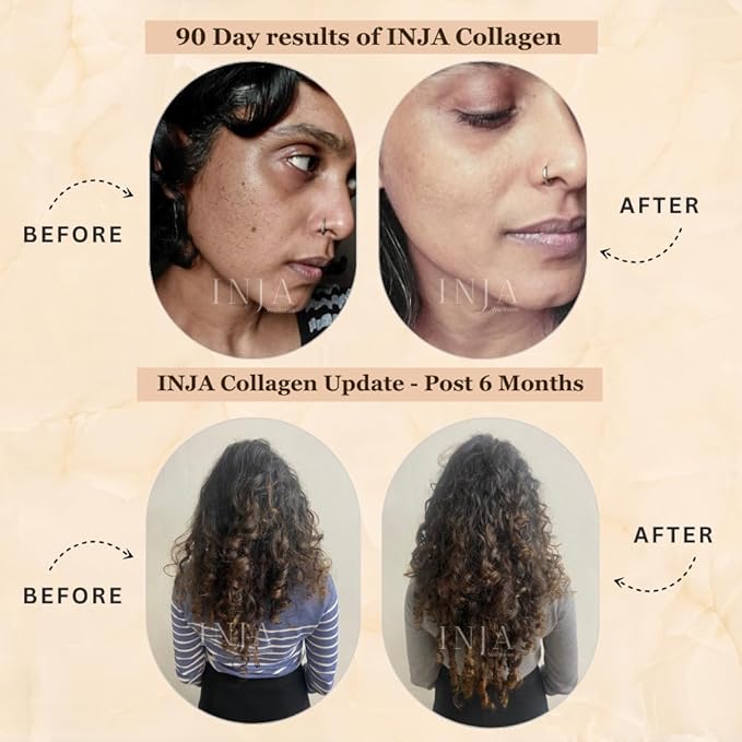 INJA Wellness Veg Collagen Supplement for Women Men 100% Vegetarian Collagen Only Original Veg Collagen Powder No added sugar Improves Skin and Hair Health Reduce Fine Line and Wrinkles