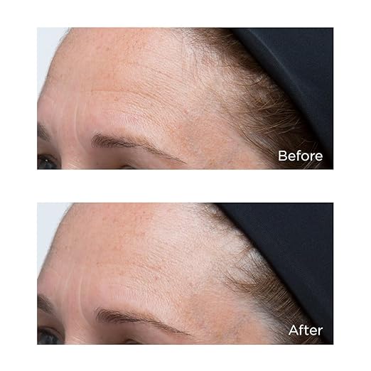 Perricone MD High Potency Classics Hyaluronic Intensive Moisturizer