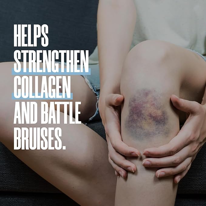 ZAX'S Bruise Vitamin Pharmacist Developed Bruising Supplements Potent Bruising Swelling Reducer Zinc Vitamin K D3 Ascorbic Acid Citrus Bioflavonoids 60 Caps Combine Arnica Bruise Cream
