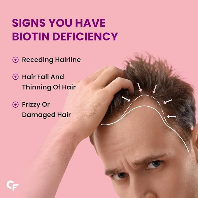 Carbamide Forte Biotin 10000mcg (High Potency) per Veg Tablet - Supports Hair Growth Glowing Skin and Strong Nails - Biotinova (120 Tablets)