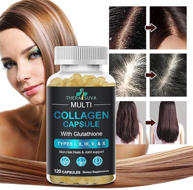 Complete Multi Collagen Complex – Types I II III V &amp X + Biotin &amp Vitamin C – Hair Skin Nails &amp Joint Support 2 Month Supply 120 Softgels