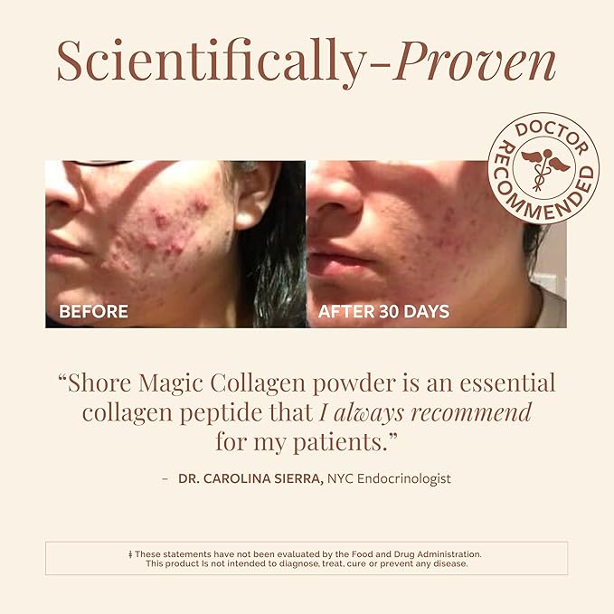 Shore Magic Premium Marine Collagen Powder – Hydrolyzed Type I II III &amp IV Peptides from Wild Fish for Skin Hair Nails &amp Joints 14 Servings