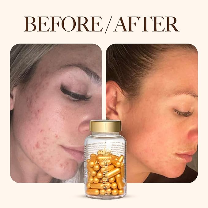 Skin Within Hair Skin &amp Nails Collagen Natural Dietary Supplement with Vitamin C and Marine Collagen 30 Day Supply 60 Capsules