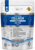 The Intelligent Health Hydrolyzed Collagen Peptides Powder Grass Fed High Protein Unflavored Gluten-Free Paleo &amp Keto Friendly 10g per Serving (1kg) Supports Skin Hair Nails Joints &amp