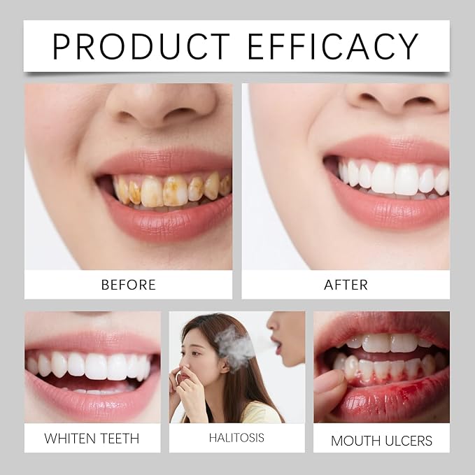 Collagen Tooth Powder for Gums - 2.12 Oz Daily Oral Care Powder Breath Freshener (2PCS)