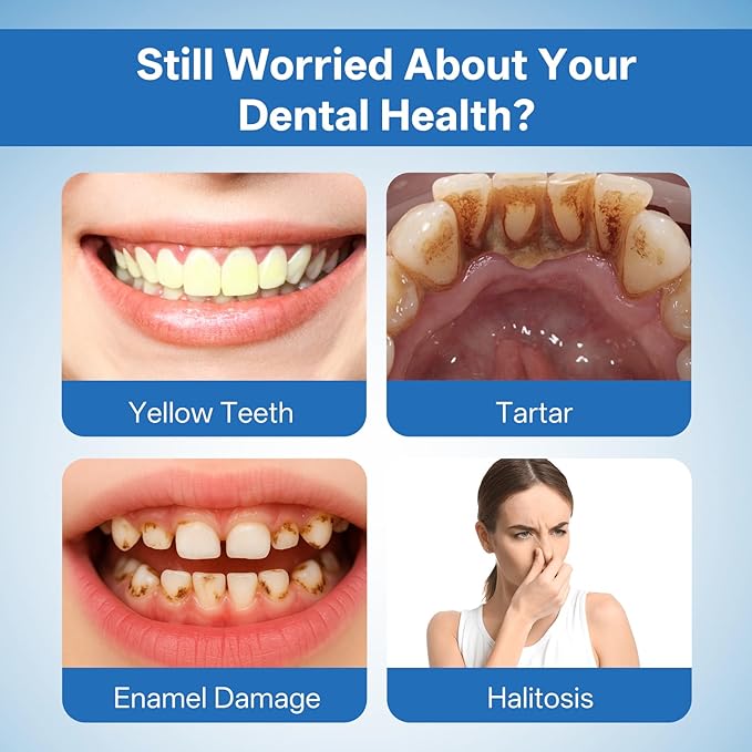 Collagen Powder for Gums Teeth Whitening Powder with Hydroxyapatite &amp Collagen Toothpaste Whitening Powder for Coffee Tea Food Wine and Tobacco Stains Strengthens Enamel &amp Gums - Fresh