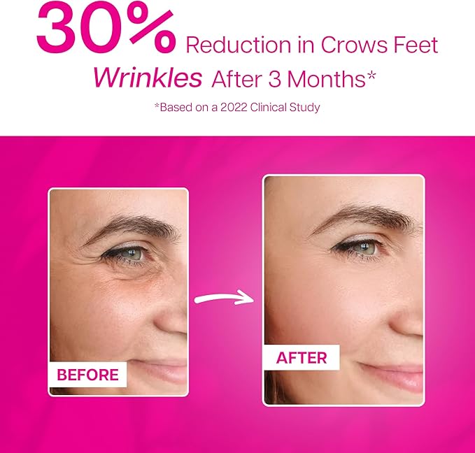 Collagen Party Norwegian Marine Super Collagen Type 1 Peptides Komecera Proline Glycine Mango Flavored for Dry Aging Skin Hair Nail Health | Easily Dissolved | Natural Sourced (1)