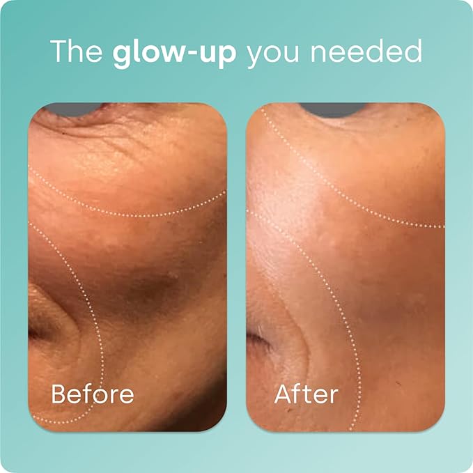 Biosil Collagen Booster Supplement - 30 Original Capsules - Patented ch-OSA Activator for Skin Hair Nails &amp Joints - Supports Natural Production - 15-Day Supply