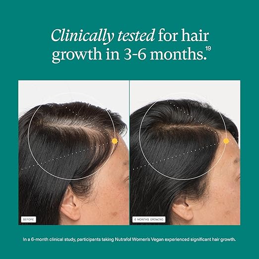 Nutrafol Women's Hair Growth Supplements For Women 18-44 Years Old Clinically Tested for Visibly Thicker Stronger Hair 100% Vegan Ingredients Dermatologist Recommended - 1 Month Supply