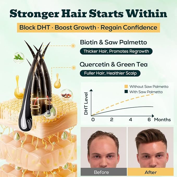 Saw Palmetto Gummies for Men – 600mg Extra Strength DHT Blocker with Biotin Pumpkin Seed – Supports Prostate Function Urinary Flow &amp Hair Regrowth Supplement 60 Passionfruit-Dragonfruit Gummies