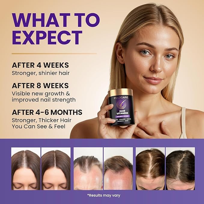 Biotin Hair Growth Supplement with Collagen Keratin and Probiotics – Hair Growth Support Skin &amp Nails Supplement for Men and Women – Supports Thicker Stronger Hair – Made in USA (2 Pack)