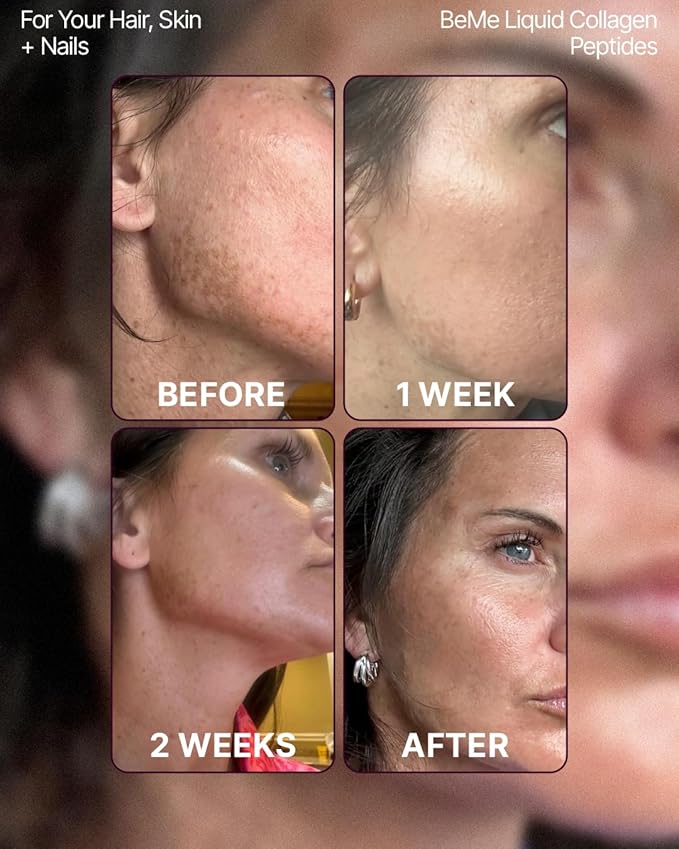 BeMe Liquid Collagen for Women - 2500mg Verisol hydrolyzed Marine Liquid Collagen - Clinically Tested Collagen Supplements - Quick Absorption high bioavailability - Supports Skin Hair &amp Nails