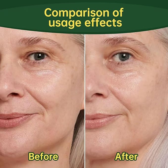 Collagen Peptide Oral Drops 30ml Lift &amp Firm Sagging Skin &amp Reduce Wrinkle Formation 2026 New Natural Supplements for Women and Men(2)