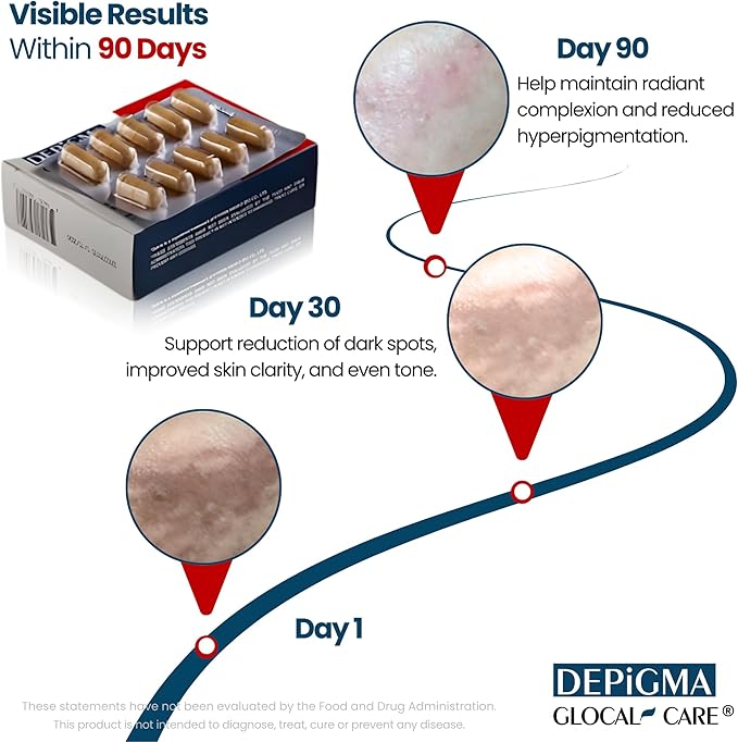 GlocalCare Depigma Support Reduction of Hyperpigmentation Melasma &amp Dark Spots with Glutathione Polypodium Leucotomos Grape Seed &amp Marigold Extract