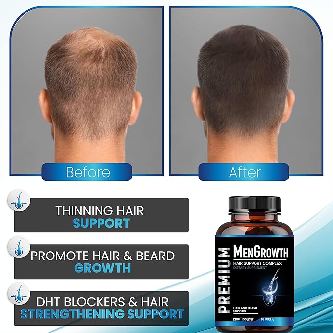 Mens Hair Growth-Hair Vitamins For Men. Anti Hair Loss Supplement Regrow Hair &amp Beard Growth Pills With DHT Blocker For Thinning Hair &amp Hair Thickening With Biotin &amp Saw Palmetto.Thicker