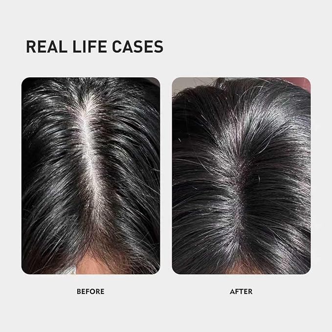 Kintor 0.5% KX-826 Hair Density Serums DHT Blocker Hair Repair Thicker Strengthening Fuller-looking Healthier Hair Reducing Hair Loss for Men and Women for All the Day 60ml