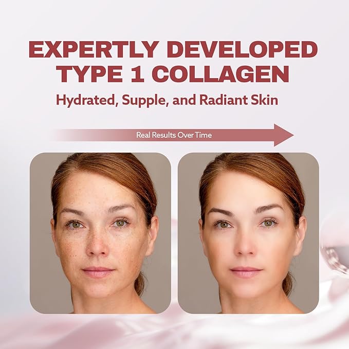 ILO Liquid Collagen Drink – 3000mg Type 1 Marine Collagen with Biotin &amp Ceramide | Skin Glow &amp Hydration | Orange Flavor | 8 Bottles – Korean Beauty Supplement
