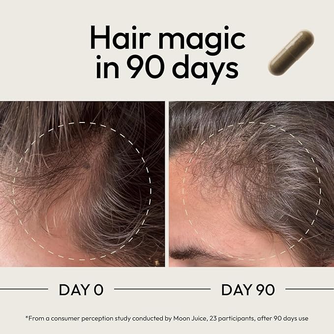 Moon Juice SuperHair Hair Growth Vitamins for Women &amp Men with Biotin &amp Saw Palmetto - Clinical Strength Multivitamin Hair Supplement for Healthier Stronger Thicker Hair 120 Capsules - 30 S