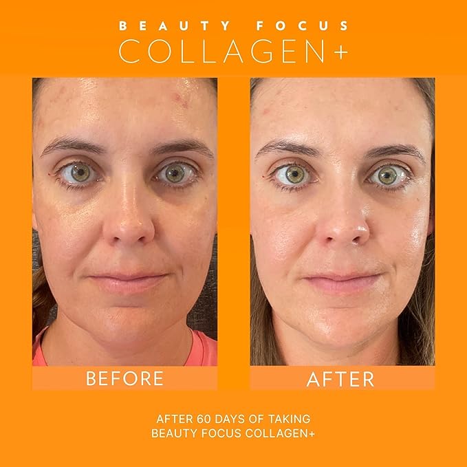 Nu Skin Beauty Focus Collagen+ | Marine Collagen Liquid Supplement with Lutein &amp Wheat Lipids | Supports Skin Hydration Elasticity &amp Smooth Appearance | 30 Pouches | Strawberry