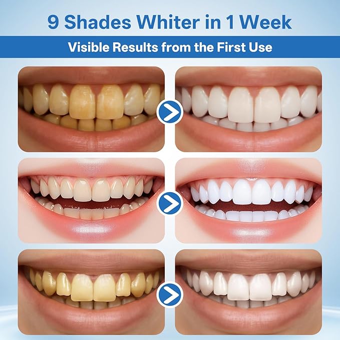 Collagen Powder for Gums Teeth Whitening Powder with Hydroxyapatite &amp Collagen Toothpaste Whitening Powder for Coffee Tea Food Wine and Tobacco Stains Strengthens Enamel &amp Gums - Fresh