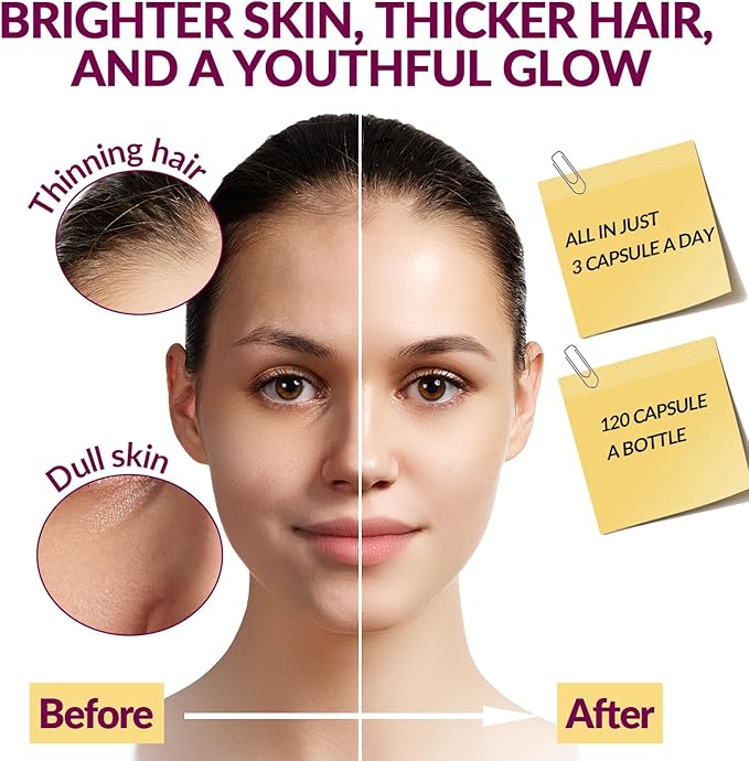 Collagen Peptides for Women Hydrolyzed Collagen Capsules - Type I II III V X - 1500mg Multi Collagen with Biotin Hyaluronic Acid Keratin Vitamin C