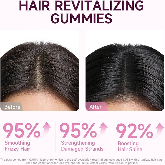 Hair Skin and Nails Gummies All-in-One Advanced Formula Supports Hair Growth - Skin Health &amp Nail Strength - 30 Gummies