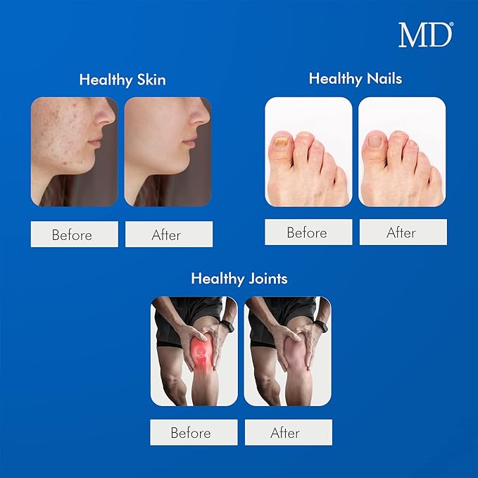 MD Ultimate Beauty Drink Powder CollagenType I &amp III | Collagen Dietary Supplement with Antioxidants | Provides Nutritional Support to Skin Hair Nails Joints | 150 Grams
