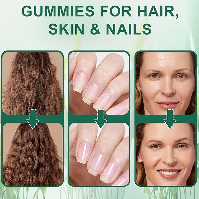 Sea Moss Gummies for Hair LossHair Loss Gummies with Organic Sea MossPearl Powder &amp Aloe VeraVitamin C Vitamin E Supports Hair &amp Skin Wellness Dietary Supplement — 60 Gummies