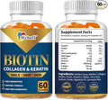 Biotin Gummies for Hair Growth Skin &amp Nails (60 Count) Strength Biotin Vitamins for Women &amp Men Gluten-Free Vegan Strawberry Flavor 60 Gummies (60 Count (Pack of 2))