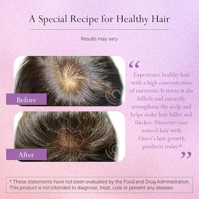 Omvi Formulas Hair Growth Supplement with Biotin 20000mcg Collagen Keratin Vitamin A C D3 &amp B12 Stronger Hair Skin and Nails Non-GMO Gluten Free 120Capsules