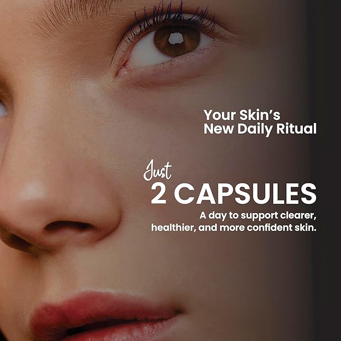 Acne+ Teen Skin Supplement – Vitamins A C E B Biotin &amp Pantothenic Acid – Supports Clear Skin Balanced Oil Production &amp Healthy Glow – 90 Vegetarian Capsules