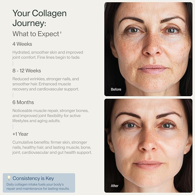 CollaVita Collagen Peptides (2 Month Supply) Grass-Fed Pasture-Raised Hydrolyzed Collagen Powder Type I &amp III Hair Nails Skin &amp Joints Non-GMO Paleo &amp Keto Unflavored 10 oz 2 Pack 30