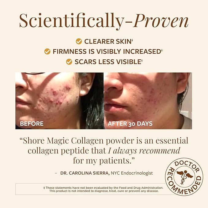 Shore Magic Premium Marine Collagen Powder Types I-IV – Wild Fish Hydrolyzed Peptides Unflavored 9g Protein Per Serving – Supports Youthful Skin Hair Nails &amp Joints 30-Day Supply