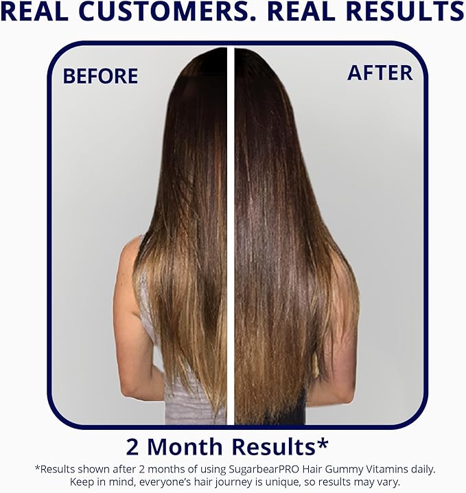 SugarBearPro Hair Vitamin Gummy 6 Month Supply Extra Strength Biotin 6000mcg Growth for Men &amp Women Vegan Vitamin B12 MSM Inositol Omega 3 Elderberry Certified Kosher Halal Cruelty-Free