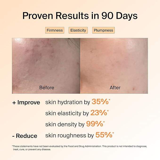 Ownist Triple Collagen Liquid Packets On-The-Go - Peptides with Hydrolyzed Marine Collagen Elastin Hyaluronic Acid and Vitamin for Healthy Skin - Orange Flavor - 14 Individual Stick Packs