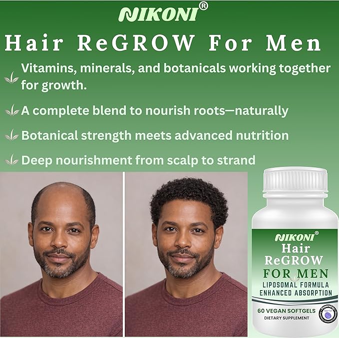 Nikoni Hair ReGROW for Men – Liposomal Hair Support Liposomal Formula with Biotin Keratin Saw Palmetto &amp Essential Nutrients-60 Vegan Softgels