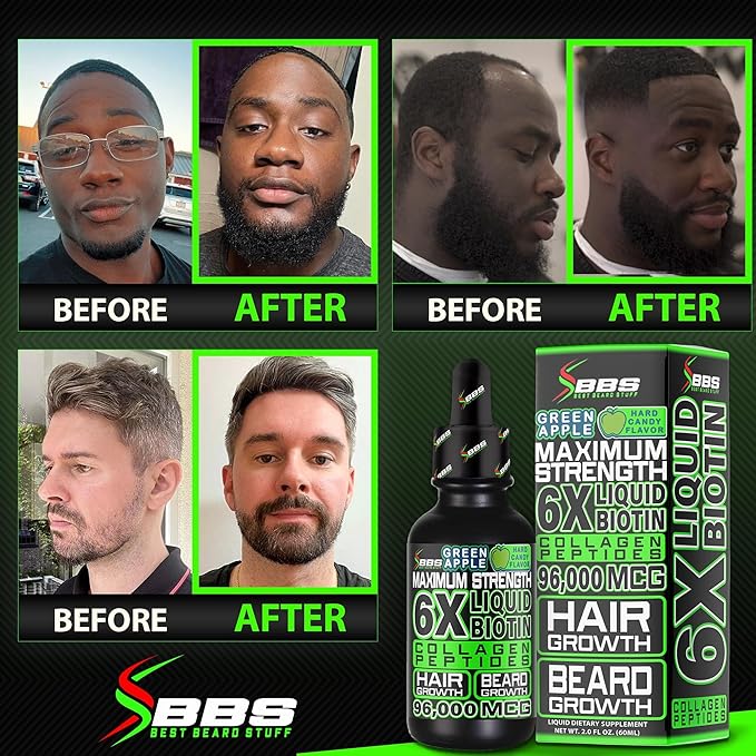 Beard Growth Kit w/ 6X Liquid BIOTIN Supplement with Collagen Peptides + 620000mcg 14-in-1 BIOTIN Gummies/Beard Growth Vitamins &amp Hair Growth Vitamins for Men - Formulated in America