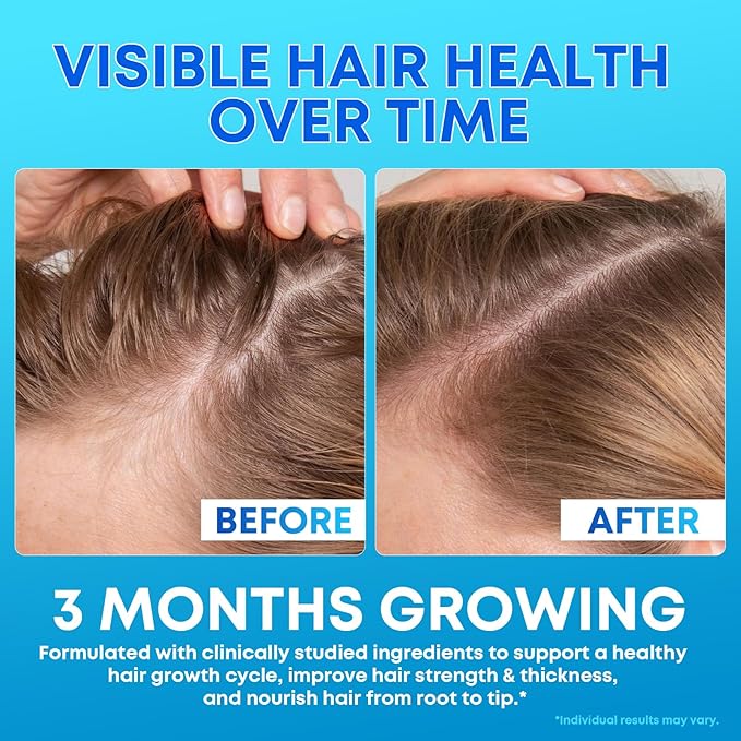 Biotin Gummies 10000mcg with Collagen - 23-in-1 Hair Growth Gummies for Women &amp Men - Hair Skin and Nails Gummies with Keratin &amp Saw Palmetto - Sugar Free Non-GMO Blueberry 180 Count