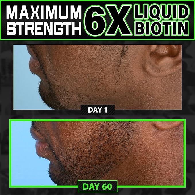Beard Growth Kit w/Grow XXL Beard Oil/Facial Hair Serum for Men + 14-in-1 BIOTIN Gummies/Hair Growth Vitamins for Men + 6X Liquid Biotin with Collagen Peptides - Formulated in America