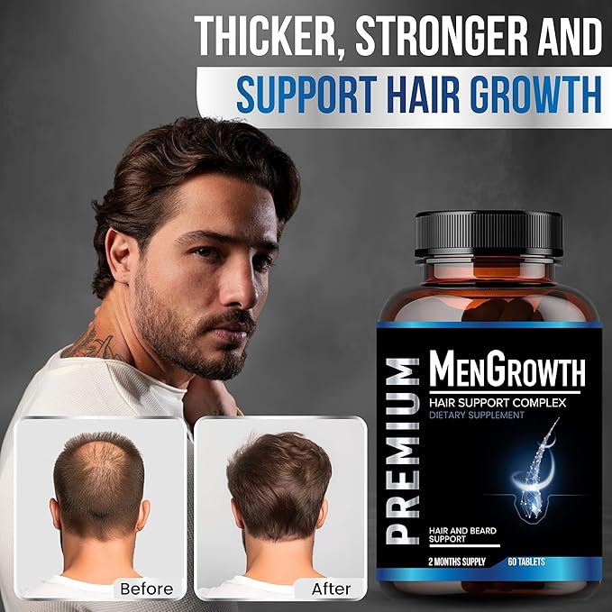 Mens Hair Growth-Hair Vitamins For Men. Anti Hair Loss Supplement Regrow Hair &amp Beard Growth Pills With DHT Blocker For Thinning Hair &amp Hair Thickening With Biotin &amp Saw Palmetto.Thicker