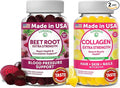 Lunakai Beet Root and Collagen Gummies Bundle 200mg Hydrolyzed Collagen Gummies for Women and Men with Biotin Zinc Vitamin C and E - Non-GMO Anti Aging
