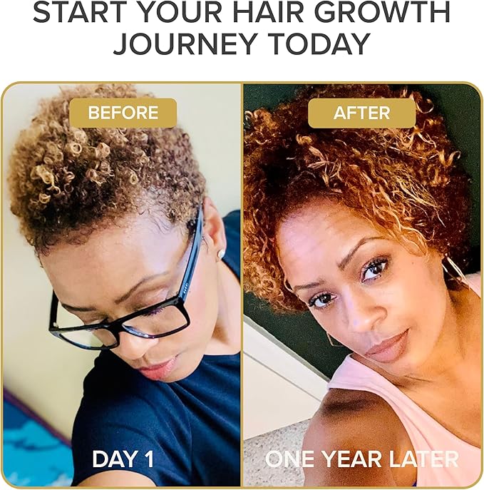 Shedavi Iconic Natural Hair Vitamins for Fast Hair Growth - Pure Hair Supplements Formulated with Vitamins to Promote Thicker Stronger Hair - Vegan Hair Care for Hair Loss - Non-GMO (60 Capsules)