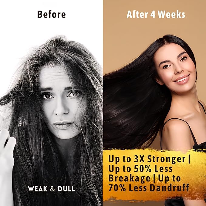 Hair Growth Serum Women &amp Men — USDA Organic Tricho10™ Natural Scalp Serum with 10 Botanical Oils for Reduced Shedding Improved Hair Density &amp Visible Hair Growth in 90 Days — All Hair Types