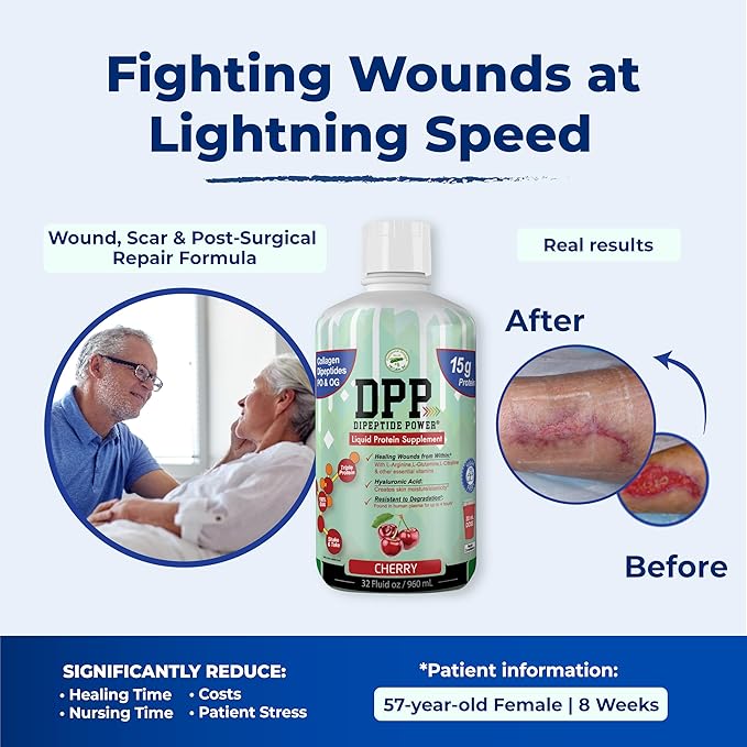 Nutritional Designs DPP Dipeptide Wound-Healing Liquid Collagen &amp Whey Protein Supplement Sugar-Free Promotes Healthy Skin &amp Hair for Men &amp Women (Watermelon Bottle 32 Fl Oz)